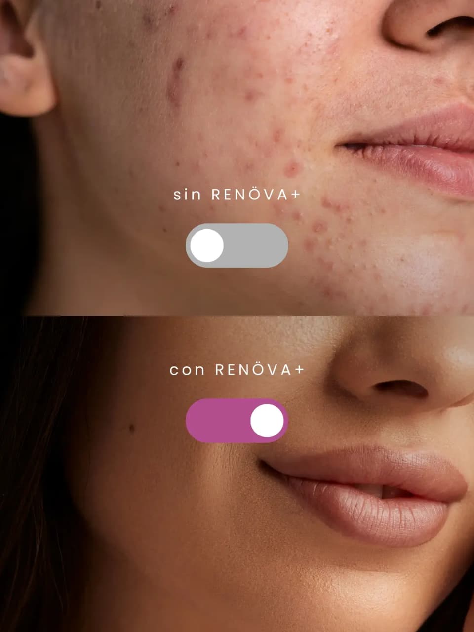 COLAGENO RENOVA